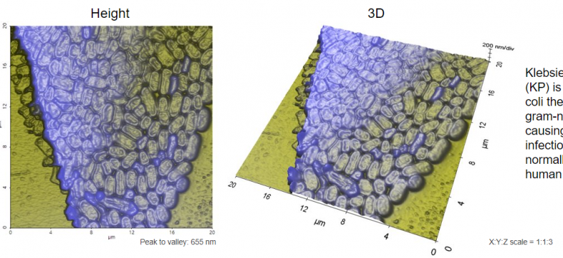 Bacteria_Klebsiella_pneumoniae