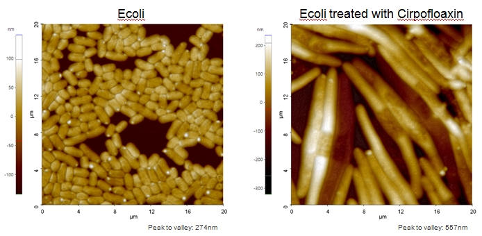 Ecoli Ecoli treated with Cirpofloaxin